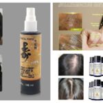 Daftar Bonanza Anti Rontok Terbaik untuk Rambut Anda