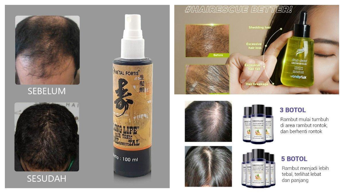 Daftar Bonanza Anti Rontok Terbaik untuk Rambut Anda